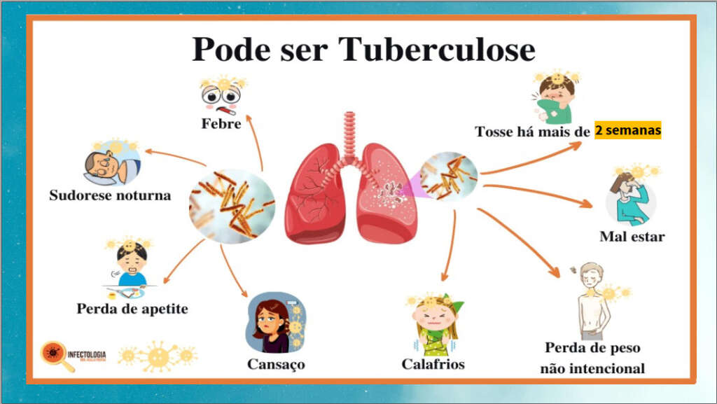 tubereculose