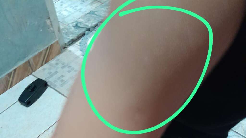 Agressão e Expulsão. Crianças com TDAH e Autistas estão sofrendo nas Escolas Municipais de Pirassununga 2 54e69ad6 d657 4367 ba5b b82b802e2a86