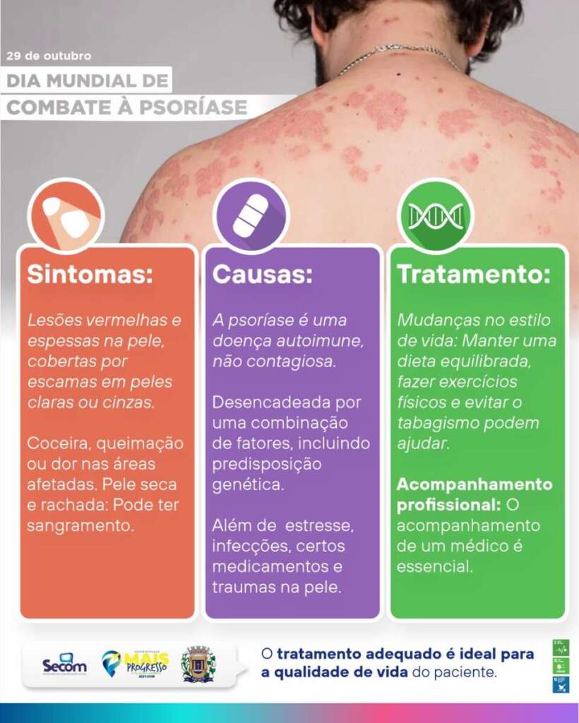 SECOM de Leme divulga as principais ações em andamento pelo município 2 Dia munidal e nacional de combare a psoriase