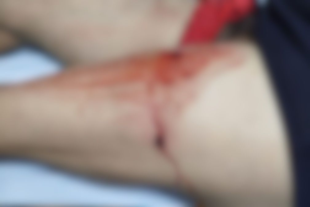 Após esfaquear vítimas, homem tenta agir contra GCM que é alvejado com dois disparos 2 632b78b4 e034 4146 9e5a 680bfd8c63a3